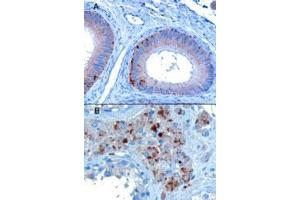 VPS35 polyclonal antibody  staining of paraffin embedded human testis showing A) Epithelial cells of the epididymis and B) Some leydig cells. (VPS35 anticorps  (C-Term))