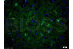 Formalin-fixed and paraffin embedded rat brain tissue labeled with Anti-NOS-2/iNOS Polyclonal Antibody, Unconjugated (ABIN677228) at 1:200 followed by conjugation to the secondary antibody Goat Anti-Rabbit IgG, FITC conjugated used at 1:200 dilution for 40 minutes at 37°C and DAPI (NOS2 anticorps  (AA 14-100))