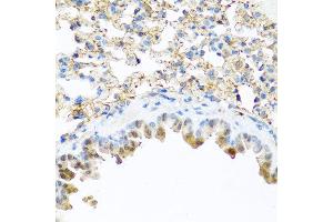 Immunohistochemistry of paraffin-embedded mouse lung using PI3 antibody at dilution of 1:100 (40x lens). (PI3 anticorps)
