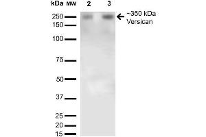 Western Blot analysis of Rat Brain Membrane and brain showing detection of 350kDa Versican protein using Mouse Anti-Versican Monoclonal Antibody, Clone S351-23 . (Versican anticorps  (AA 362-585) (Atto 594))