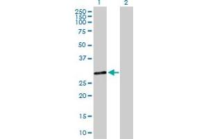Western Blot analysis of DHRS9 expression in transfected 293T cell line by DHRS9 MaxPab polyclonal antibody. (DHRS9 anticorps  (AA 1-319))