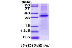 SDS-PAGE (SDS) image for Ring Finger and CHY Zinc Finger Domain Containing 1, E3 Ubiquitin Protein Ligase (RCHY1) (AA 1-261) protein (His tag) (ABIN5853062) (RCHY1 Protein (AA 1-261) (His tag))