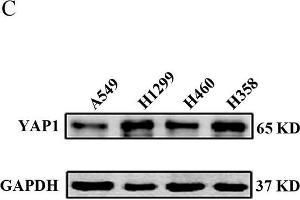 YAP1 expression levels in NSCLC tissues and NSCLC cell lines. (GAPDH anticorps)