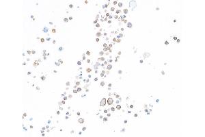 Immunocytochemistry (ICC) image for anti-Hepatitis A Virus Cellular Receptor 2 (TIM 3) (AA 22-201) antibody (ABIN7449550) (Recombinant TIM3 anticorps  (AA 22-201))