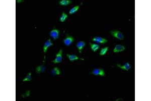 Immunofluorescence staining of A549 cells with ABIN7162659 at 1:200, counter-stained with DAPI. (PARD3 anticorps  (AA 1068-1356))