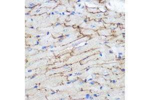 Immunohistochemistry of paraffin-embedded Mouse heart using Connexin 43 Rabbit pAb (ABIN6131701, ABIN6141098, ABIN6141099 and ABIN6215448) at dilution of 1:100 (40x lens).