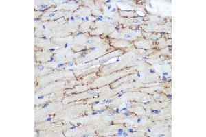 Immunohistochemistry of paraffin-embedded Mouse heart using Connexin 43 Rabbit pAb (ABIN6131701, ABIN6141098, ABIN6141099 and ABIN6215448) at dilution of 1:100 (40x lens). (Connexin 43/GJA1 anticorps  (AA 233-382))