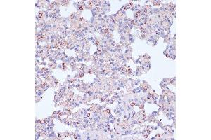 Immunohistochemistry of paraffin-embedded Rat lung using CD18 antibody (ABIN3023117, ABIN3023118, ABIN3023119 and ABIN6219398) at dilution of 1:100 (40x lens).