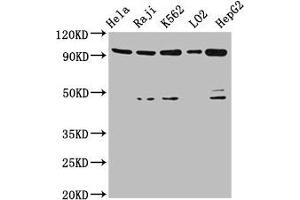 Western Blot Positive WB detected in: Hela whole cell lysate, Raji whole cell lysate, K562 whole cell lysate, LO2 whole cell lysate, HepG2 whole cell lysate All lanes: PROM1 antibody at 4.