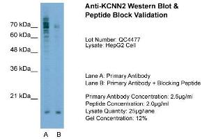 Host:  Rabbit  Target Name:  KCNN2  Sample Type:  HepG2  Lane A:  Primary Antibody  Lane B:  Primary Antibody + Blocking Peptide  Primary Antibody Concentration:  2. (KCNN2 anticorps  (C-Term))
