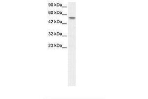 Image no. 1 for anti-Runt-Related Transcription Factor 1, Translocated To, 1 (Cyclin D-Related) (RUNX1T1) (AA 221-270) antibody (ABIN202771) (RUNX1T1 anticorps  (AA 221-270))
