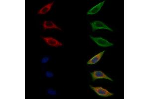 ABIN6262074 and ABIN6272312 staining Hela cells by IF/ICC. (GRAP anticorps  (C-Term))
