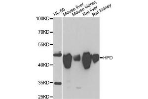 Western blot analysis of extracts of various cell lines, using HPD antibody (ABIN2563239) at 1:1000 dilution. (HPD anticorps)