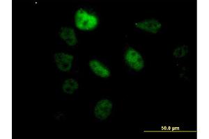 Immunofluorescence of monoclonal antibody to SF3B2 on HeLa cell. (SF3B2 anticorps  (AA 592-645))