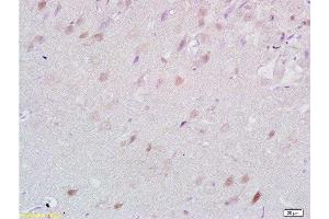 Formalin-fixed and paraffin embedded rat brain tissue labeled with Anti-Lingo-1 Polyclonal Antibody, Unconjugated  at 1:200 followed by conjugation to the secondary antibody and DAB staining (LINGO1 anticorps  (AA 521-620))