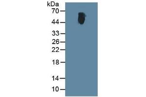 Rabbit Capture antibody from the kit in WB with Positive Control:  Human serum. (ALT Kit ELISA)