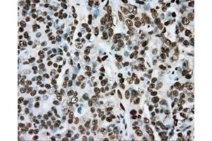 Immunohistochemical staining of paraffin-embedded colon tissue using anti-ARNT mouse monoclonal antibody. (ARNT anticorps)
