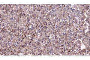 ABIN6273280 at 1/100 staining Human pancreas cancer tissue by IHC-P. (OPA3 anticorps  (Internal Region))