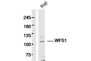 Human Raji cells probed with WFS1 Polyclonal Antibody, unconjugated  at 1:300 overnight at 4°C followed by a conjugated secondary antibody at 1:10000 for 90 minutes at 37°C.