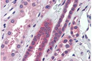 Human Kidney (formalin-fixed, paraffin-embedded) stained with ATP6V0A2 antibody ABIN462234 followed by biotinylated goat anti-rabbit IgG secondary antibody ABIN481713, alkaline phosphatase-streptavidin and chromogen.