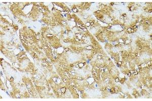 Immunohistochemistry of paraffin-embedded Rat heart using COX15 Polyclonal Antibody at dilution of 1:100 (40x lens). (COX15 anticorps)