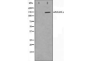 Western blot analysis on 293 cell lysate using PDGFRalpha Antibody,The lane on the left is treated with the antigen-specific peptide. (PDGFRA anticorps  (Internal Region))