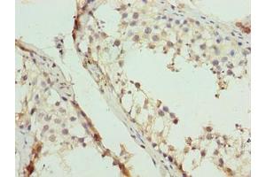 Immunohistochemistry of paraffin-embedded human testis tissue using ABIN7152217 at dilution of 1:100 (EIF5A2 anticorps  (AA 2-153))