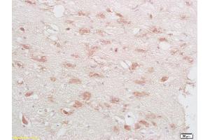 Formalin-fixed and paraffin embedded rat brain labeled with Rabbit Anti-phospho-CREB-1(Ser133) Polyclonal Antibody, Unconjugated 1:500 followed by conjugation to the secondary antibody (CREB1 anticorps  (pSer133))