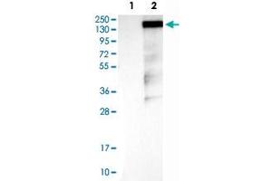 Western Blot analysis of Lane 1: negative control (vector only transfected HEK293T cell lysate) and Lane 2: over-expression lysate (co-expressed with a C-terminal myc-DDK tag in mammalian HEK293T cells) with RAPGEF1 polyclonal antibody . (GRF2 anticorps)