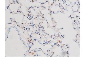 ABIN6267503 at 1/200 staining Rat lung tissue sections by IHC-P. (STAT3 anticorps  (pSer727))