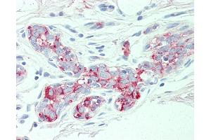 Anti-SLC4A2 antibody IHC of human breast. (SLC4A2 anticorps  (N-Term))