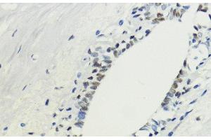 Immunohistochemistry of paraffin-embedded Human breast using TriMethyl-Histone H3-K36 Polyclonal Antibody at dilution of 1:200 (40x lens). (Histone 3 anticorps  (3meLys36))