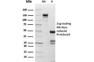 SDS-PAGE Analysis Purified Topoisomerase II alpha, Monoclonal Antibody (TOP2A/1361). (Topoisomerase II alpha anticorps  (AA 1352-1493))