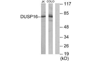 Western Blotting (WB) image for anti-Dual Specificity Phosphatase 16 (DUSP16) (C-Term) antibody (ABIN1849942)