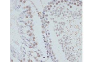 Immunohistochemistry of paraffin-embedded Rat testis using Phospho-ERK1(T202/Y204)/ ERK2(T185/Y187) Polyclonal Antibody at dilution of 1:100 (40x lens).
