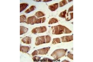 Immunohistochemistry (IHC) image for anti-CSRP2 Binding Protein (CSRP2BP) antibody (ABIN3003941)