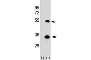 Western blot analysis of ATG5 antibody and 293 cell lysate (2 ug/lane) either nontransfected (Lane 1) or transiently transfected (2) with the human gene. (ATG5 anticorps  (AA 1-30))