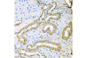 Immunohistochemistry of paraffin-embedded rat kidney using ABL1 antibody at dilution of 1:100 (x40 lens). (ABL1 anticorps)