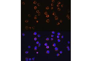 Immunofluorescence analysis of Jurkat cells using CD27 Rabbit mAb (ABIN7266175) at dilution of 1:100 (40x lens).