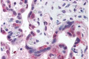 Human Placenta (formalin-fixed, paraffin-embedded) stained with TLR3 antibody ABIN214574 at 5 ug/ml followed by biotinylated goat anti-rabbit IgG secondary antibody ABIN481713, alkaline phosphatase-streptavidin and chromogen. (TLR3 anticorps  (N-Term))