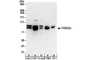 Western Blotting (WB) image for anti-Forkhead Box O3 (FOXO3) (C-Term) antibody (ABIN7454632)