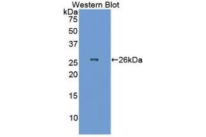 Detection of Recombinant GSTa1, Human using Polyclonal Antibody to Glutathione S Transferase Alpha 1 (GSTa1)