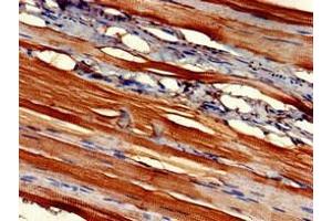 Immunohistochemistry of paraffin-embedded human skeletal muscle tissue using ABIN7152871 at dilution of 1:100 (Fibromodulin anticorps  (AA 18-89))