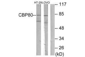 Western blot analysis of extracts from HT-29 cells and LOVO cells, using NCBP1 antibody. (NCBP1 anticorps  (N-Term))