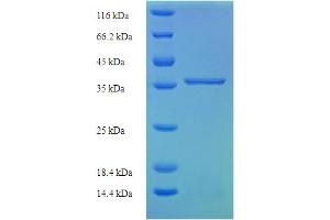 SDS-PAGE (SDS) image for Complement Component 8, gamma Polypeptide (C8G) (AA 21-202) protein (His-SUMO Tag) (ABIN5709171)
