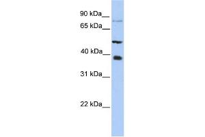 WB Suggested Anti-METTL2B Antibody Titration:  0. (METTL2B anticorps  (N-Term))
