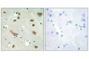 Immunohistochemistry analysis of paraffin-embedded human brain tissue using 14-3-3 γ antibody. (14-3-3 gamma anticorps)