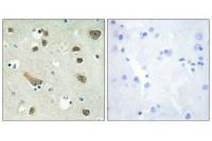 Immunohistochemistry analysis of paraffin-embedded human brain tissue using 14-3-3 γ antibody.