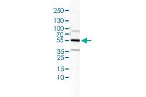 Western Blot (Cell lysate) analysis of U-138 cell lysate. (IL1R1 anticorps)