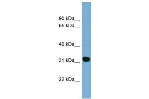 WB Suggested Anti-CBR1  Antibody Titration: 0. (CBR1 anticorps  (Middle Region))